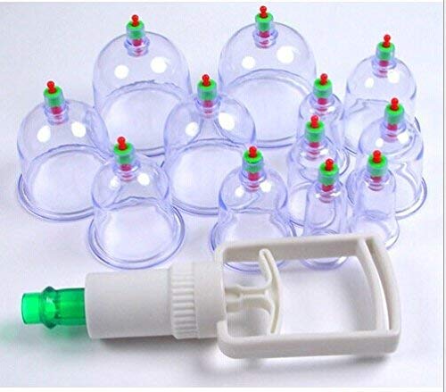 buy cupping and acupuncture